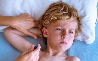 Atopowe zapalenie skóry u dzieci czego unikać na co dzień?